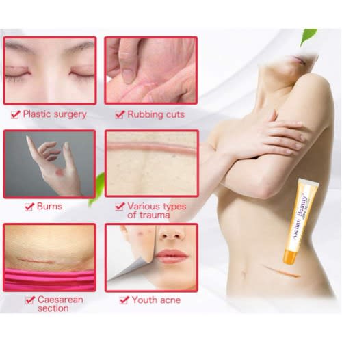 Aichun Beauty Gel Cream Sunscreen Remove Old & New Acne Scar Spf30 - 20g.