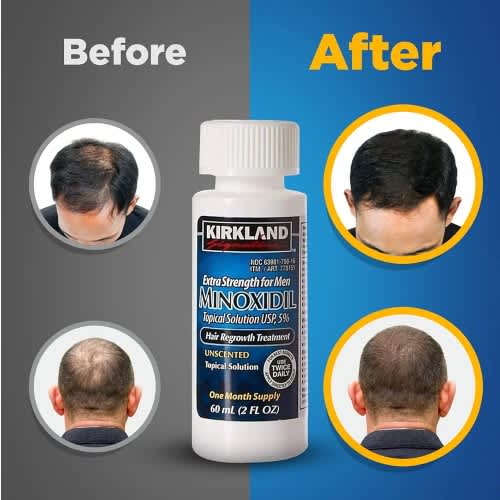 Minoxidil 5% Hair & Beard Regrowth, Topical Solution- 60ml - View 1