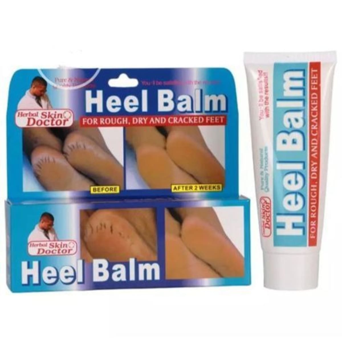 Feet rough and cracked deals