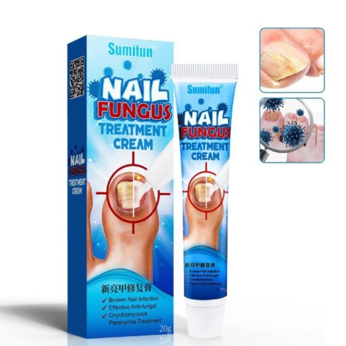 Treatment Nail Repair Fungus Cream - China Nail Fungal Solution, Nail  Fungal Treatment | Made-in-China.com
