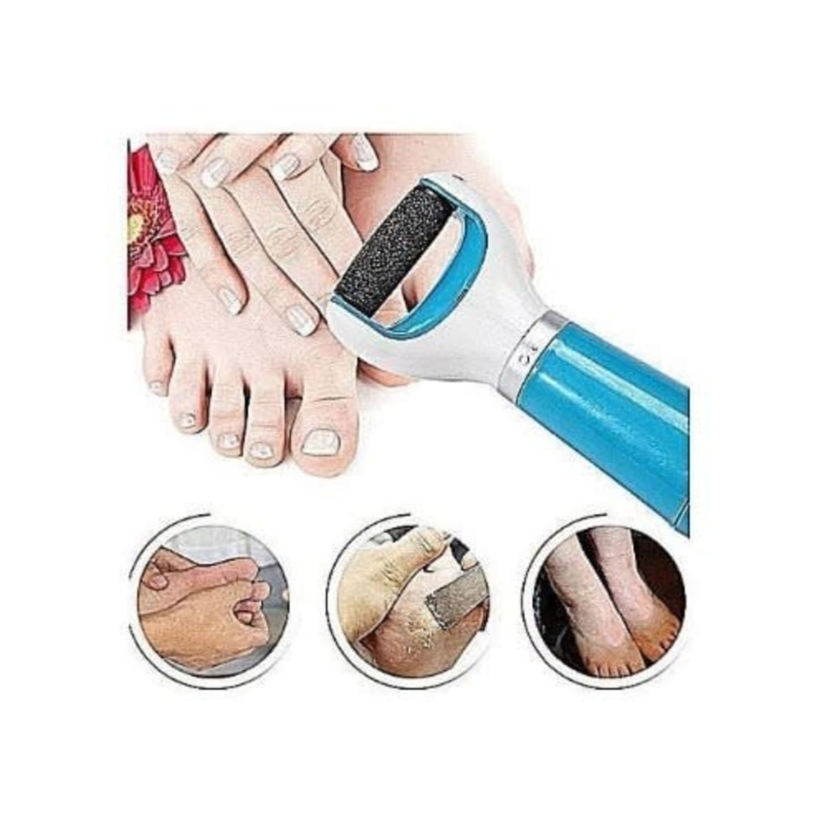 Electric Callus Remover for Feet - Waterproof with 1 Replaceable Abras –  Elbahya