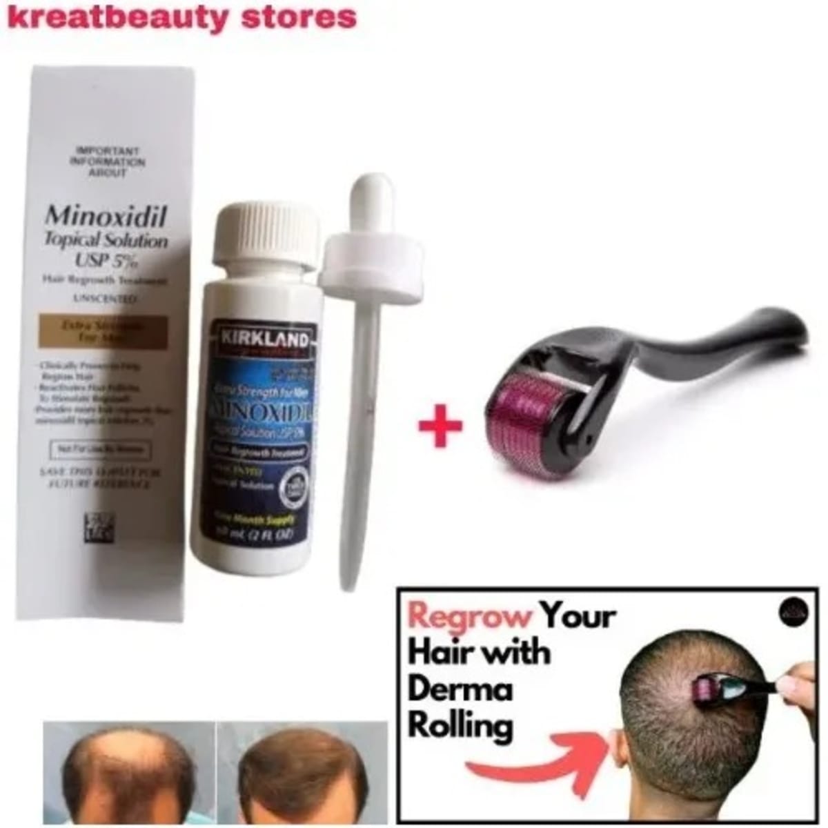 Minoxidil 5 shop kirkland