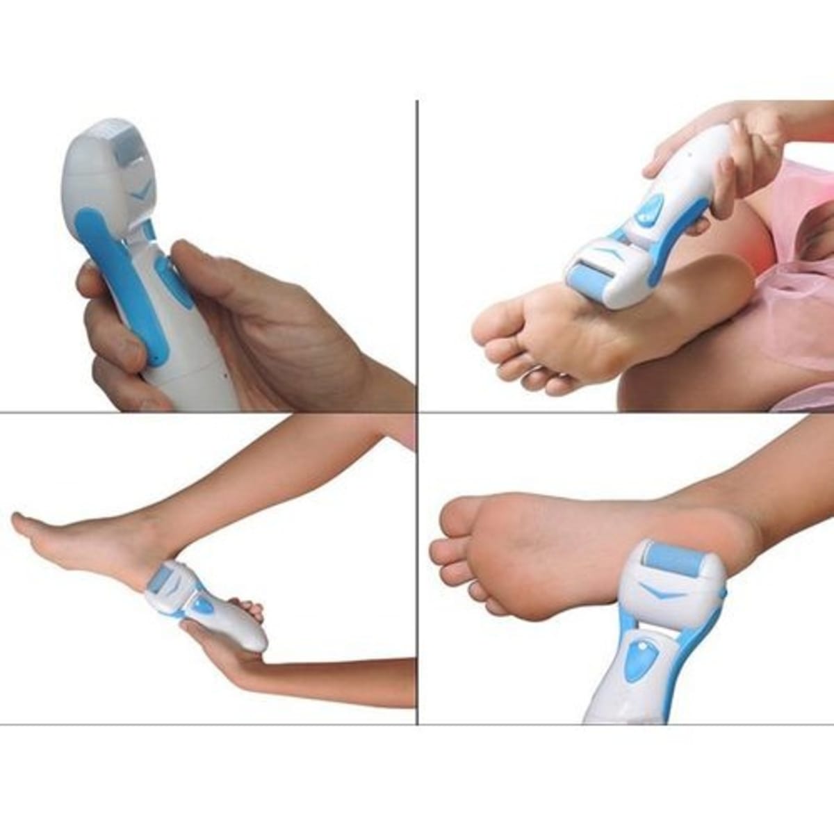 Hard skin on sale heels remover