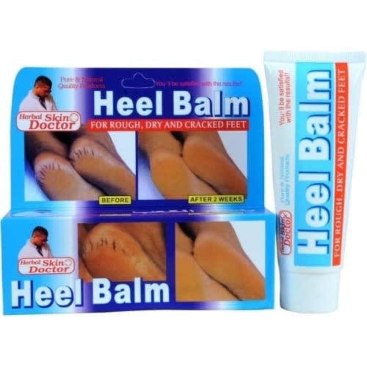 Rough cracked feet hot sale
