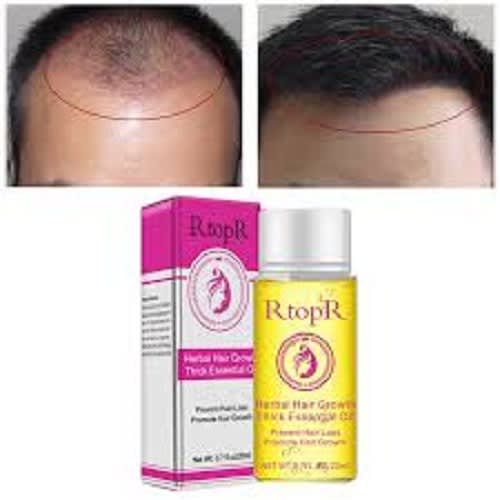 Instant New Herbal Hair Growth Thick Essential Oil Anti Hair