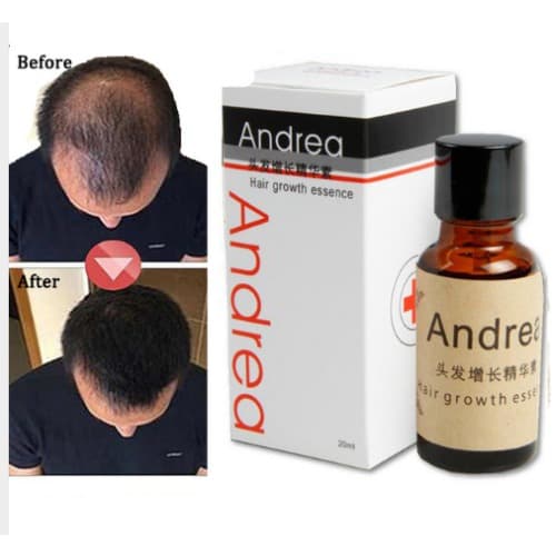 Andrea Hair Regrowth Treatment Serum - 20ml | Konga Online Shopping