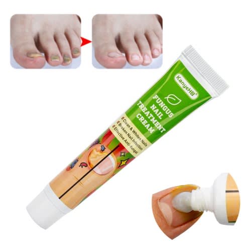 KanyeHB Fungus Nail Treatment Cream 20g Konga Online Shopping