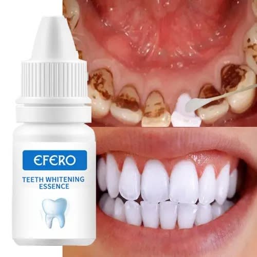 Efero Teeth Whitening Essence Konga Online Shopping