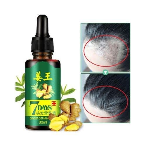 Hairole Ten 10 Days Hair Oil (For Men & Women) Hair Oil (100 ml) PACK  OF 2 | eBay